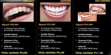 Cost of Dental Braces in the Philippines .
